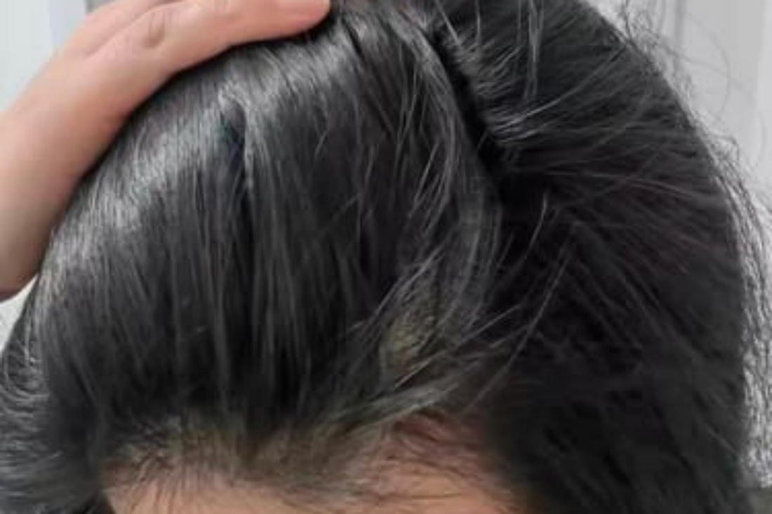 7 Mistakes That Can Cause Uneven Gray Hair Coverage