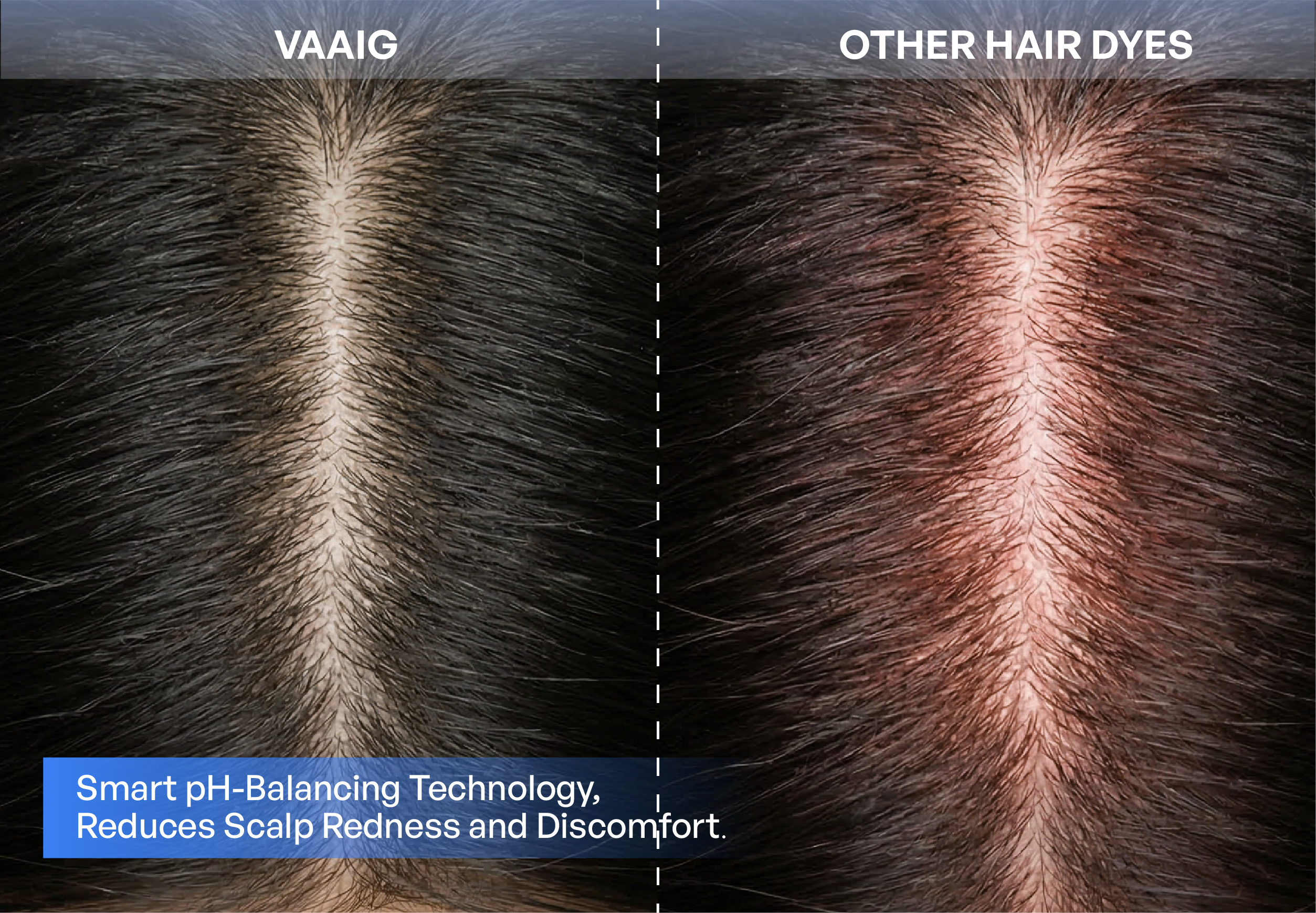 Before and after scalp health showing the benefits of non-irritating hair color: healthy scalp with our formula vs irritation from harsh chemicals.